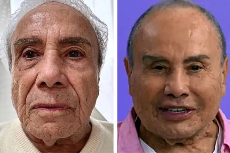 stenio garcia antes depois fofocalizando stenio garcia antes depois fofocalizando