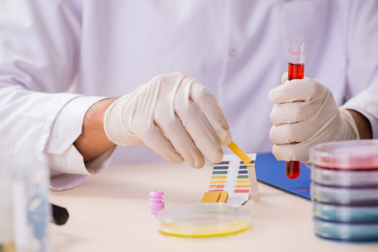 Alcalose metabolica Alcalose metabolica