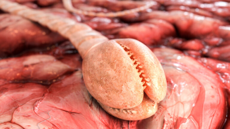 Diphyllobothrium latum Diphyllobothrium latum