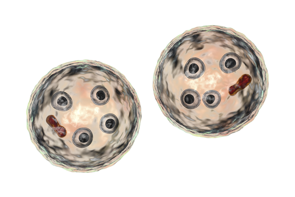 amebiase Entamoeba histolytica amebiase Entamoeba histolytica