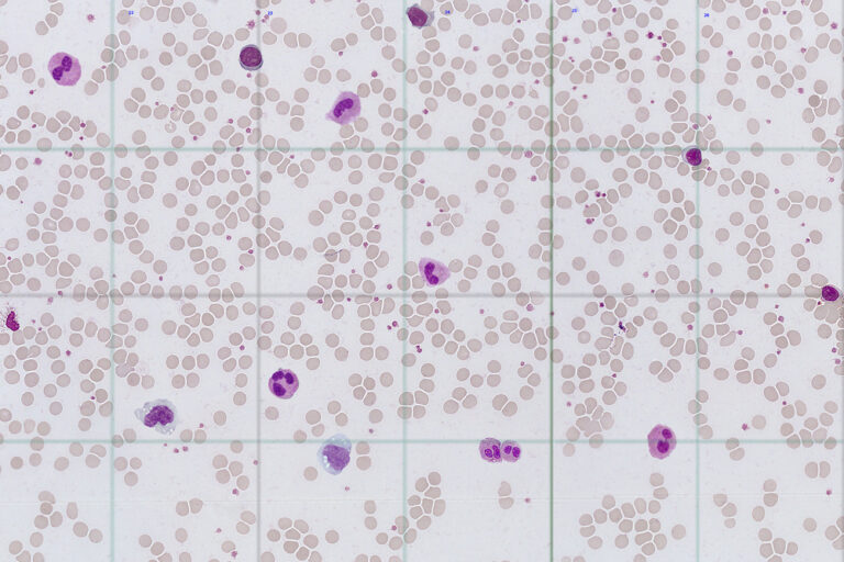 Leucograma no sangue