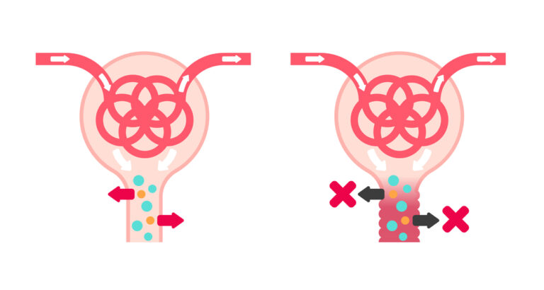 Sindrome de Fanconi sintomas