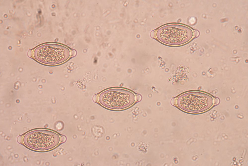 Trichuris trichiura ovos de Tricuríase