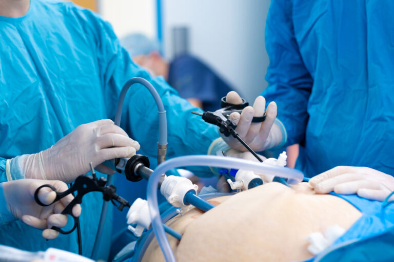 laparoscopia