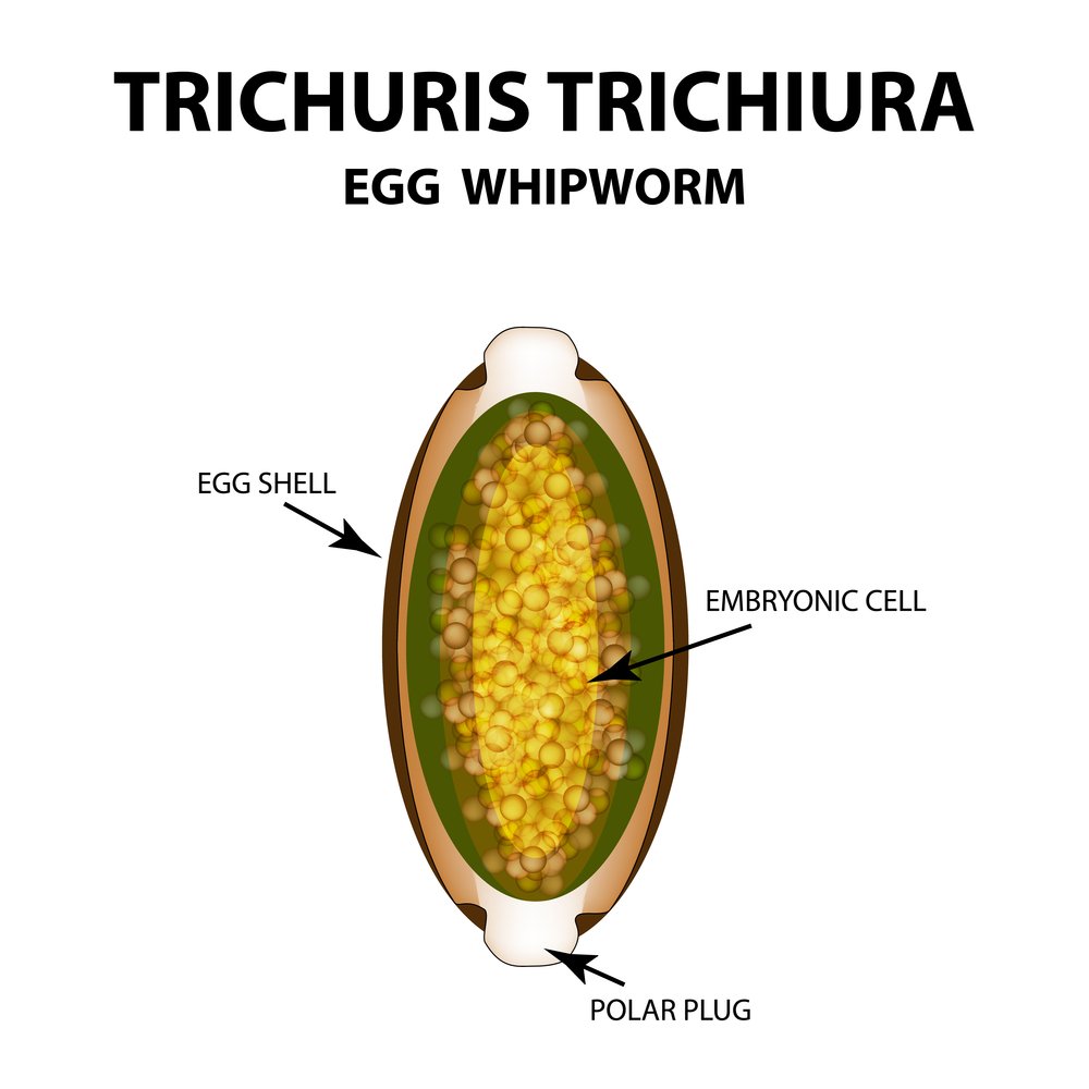 ovos de Trichuris trichiura ovos de Trichuris trichiura