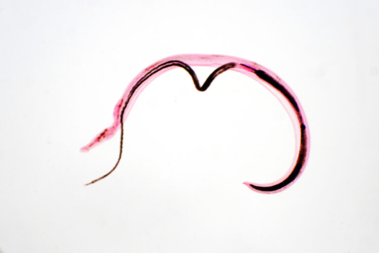 verme Trichuris trichiura